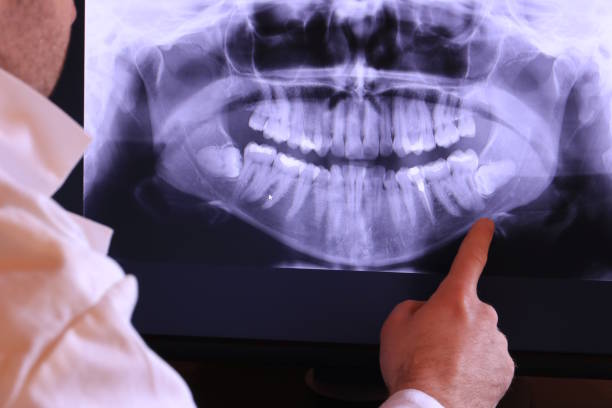 Best Urgent Tooth Repair  in Roaring Spring, PA